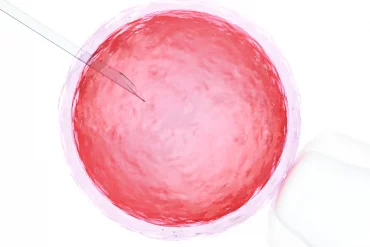 Männliche Infertilität und das Spermiogramm: oft eine Herausforderung im Kinderwunsch